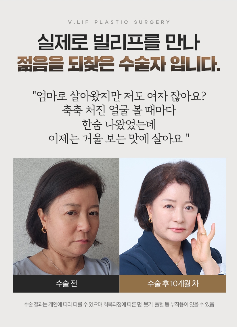 실제로 빌리프를 만나 젊음을 되찾은 수술자 입니다. 엄마로 살아왔지만 저도 여자 잖아요? 축축 처진 얼굴 볼 때마다 한숨 나왔었는데 이제는 거울 보는 맛에 살아요. 수술 전 - 수술 후 10개월 차