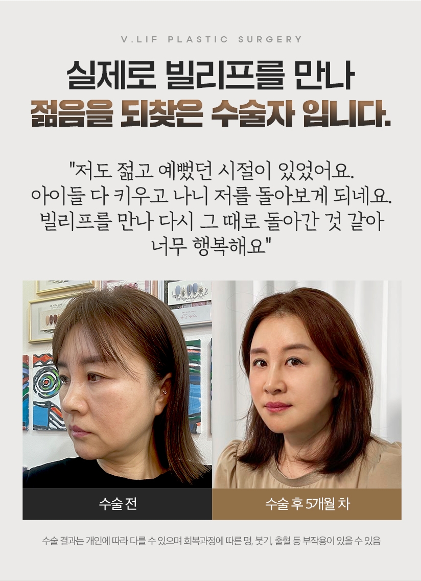 실제로 빌리프를 만나 젊음을 되찾은 수술자 입니다. 저도 젊고 예뻤던 시절이 있었어요. 아이들 다 키우고 나니 저를 돌아보게 되네요.빌리프를 만나 다시 그 때로 돌아간 것 같아 너무 행복해요. 수술 전 - 수술 후 5개월 차