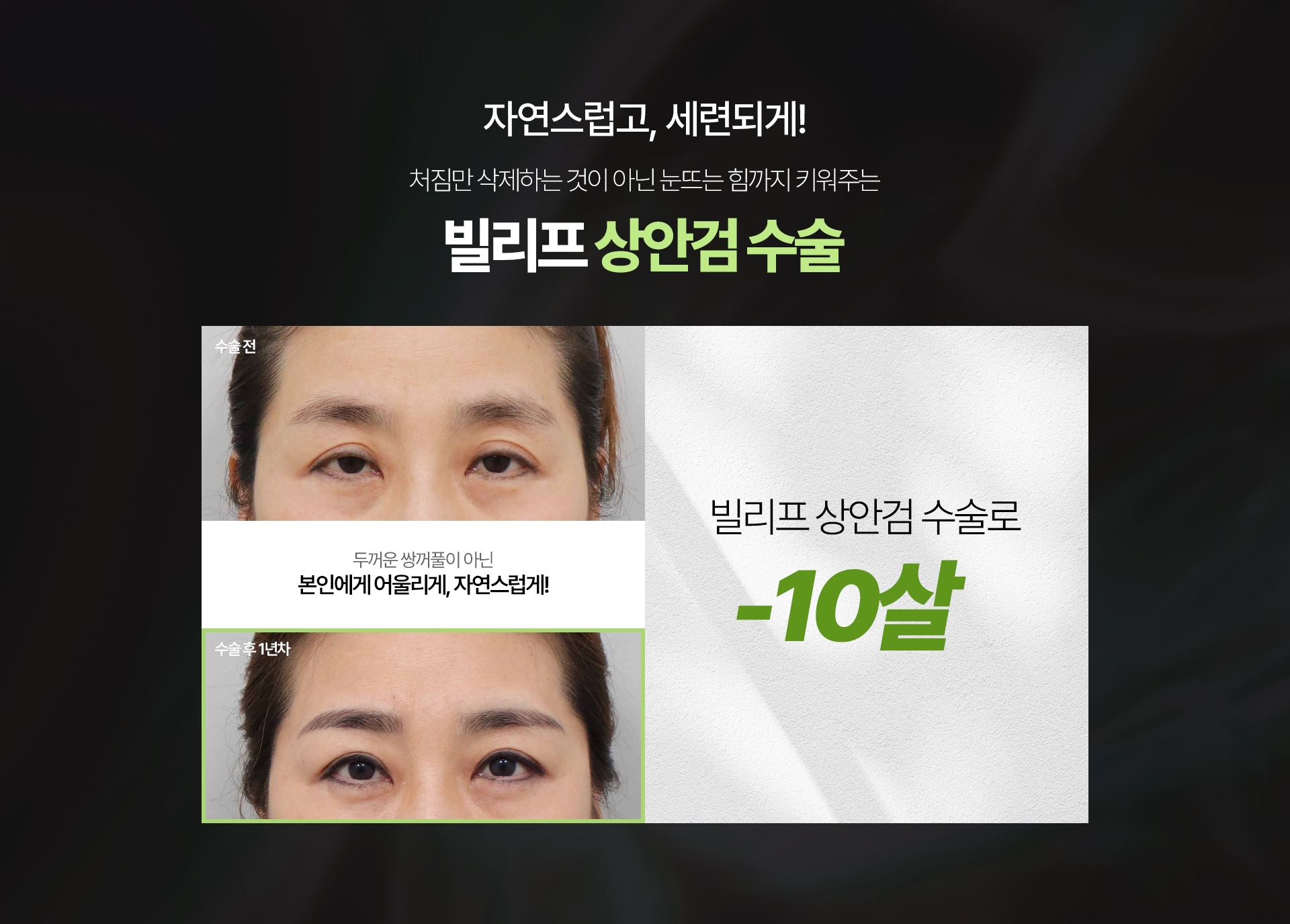 자연스럽고, 세련되게! 처짐만 삭제하는 것이 아닌 눈뜨는 힘까지 키워주는 빌리프 상안검 수술 두꺼운 쌍꺼풀이 아닌 본인에게 어울리게, 자연스럽게! 빌리프 상안검 수술로 -10살