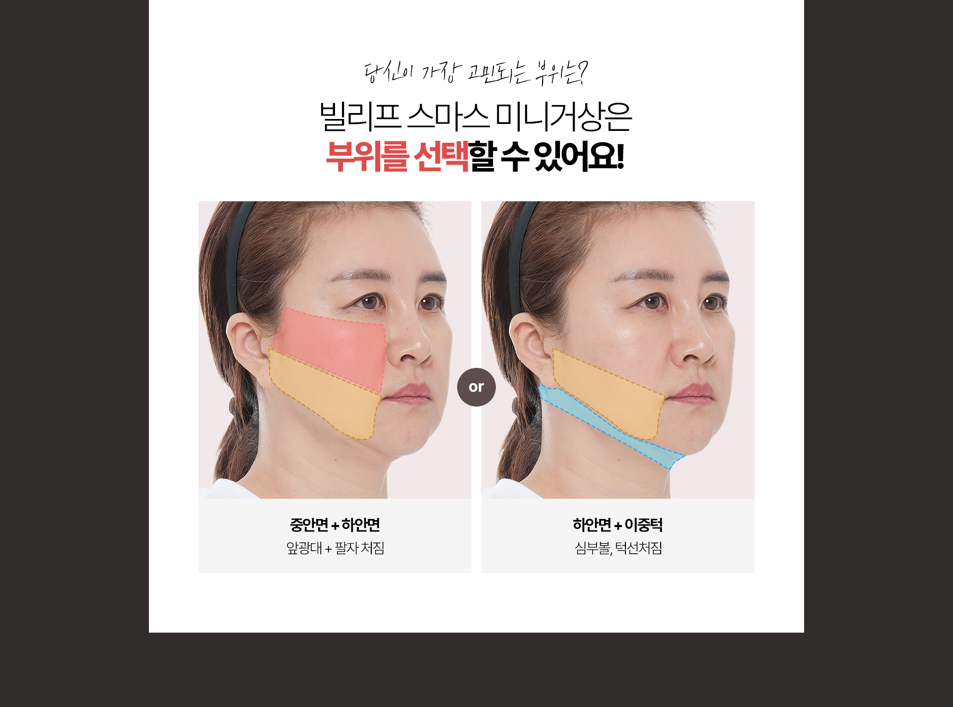 당신이 가장 고민되는 부위는? 빌리프 스마스 미니거상은 부위를 선택할 수 있어요! 이미지1 - 중안면+하안면, 앞광대+팔자 처짐 / 이미지2 하안면+이중턱, 심부볼, 턱선처짐