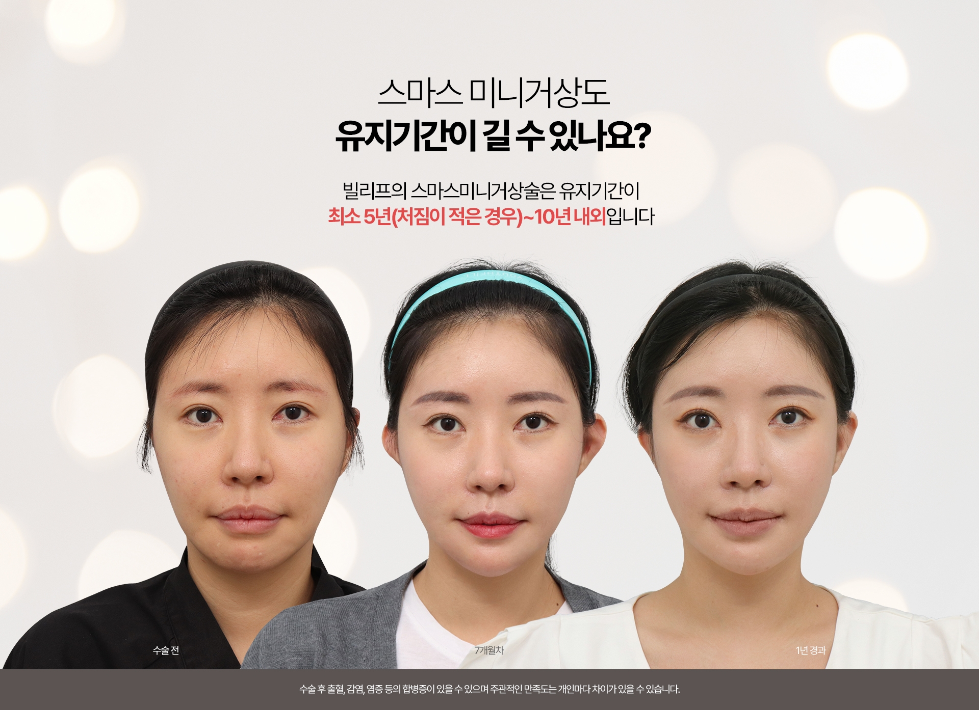 스마스 미니거상도   유지기간이 길 수 있나요? 빌리프의 스마스미니거상술은 유지기간이 최소 5년(처짐이 적은 경우)~10년 내외입니다 1년에서 1년6개월까지 흉살이 빠진 뒤부터는 만족스러운 결과가 오래 유지되는 것을 느끼실 수 있습니다.