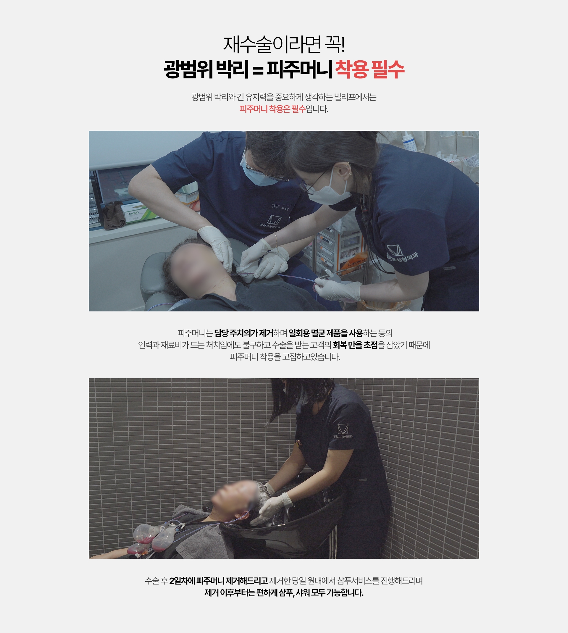 재수술이라면 꼭! 광범위 박리 = 피주머니 착용 필수 광범위 박리와 긴 유지력을 중요하게 생각하는 빌리프에서는 피주머니 착용은 필수 입니다. 피주머니는 담당 주치의가 제거하며 일회용 멸균 제품을 사용하는 등의 인력과 재료비가 드는 처치임에도 불구하고 수술을 받는 고객의 회복 만을 초점을 잡았기 떄문에 피주머니 착용을 고집하고 있습니다. 수술 후 2일차네 피주머니 제거해드리고 제거한 당일 원내에서 샴푸서비스를 진행해드리며 제거 이후부터는 편하게 샴푸, 샤워 모두 가능합니다.