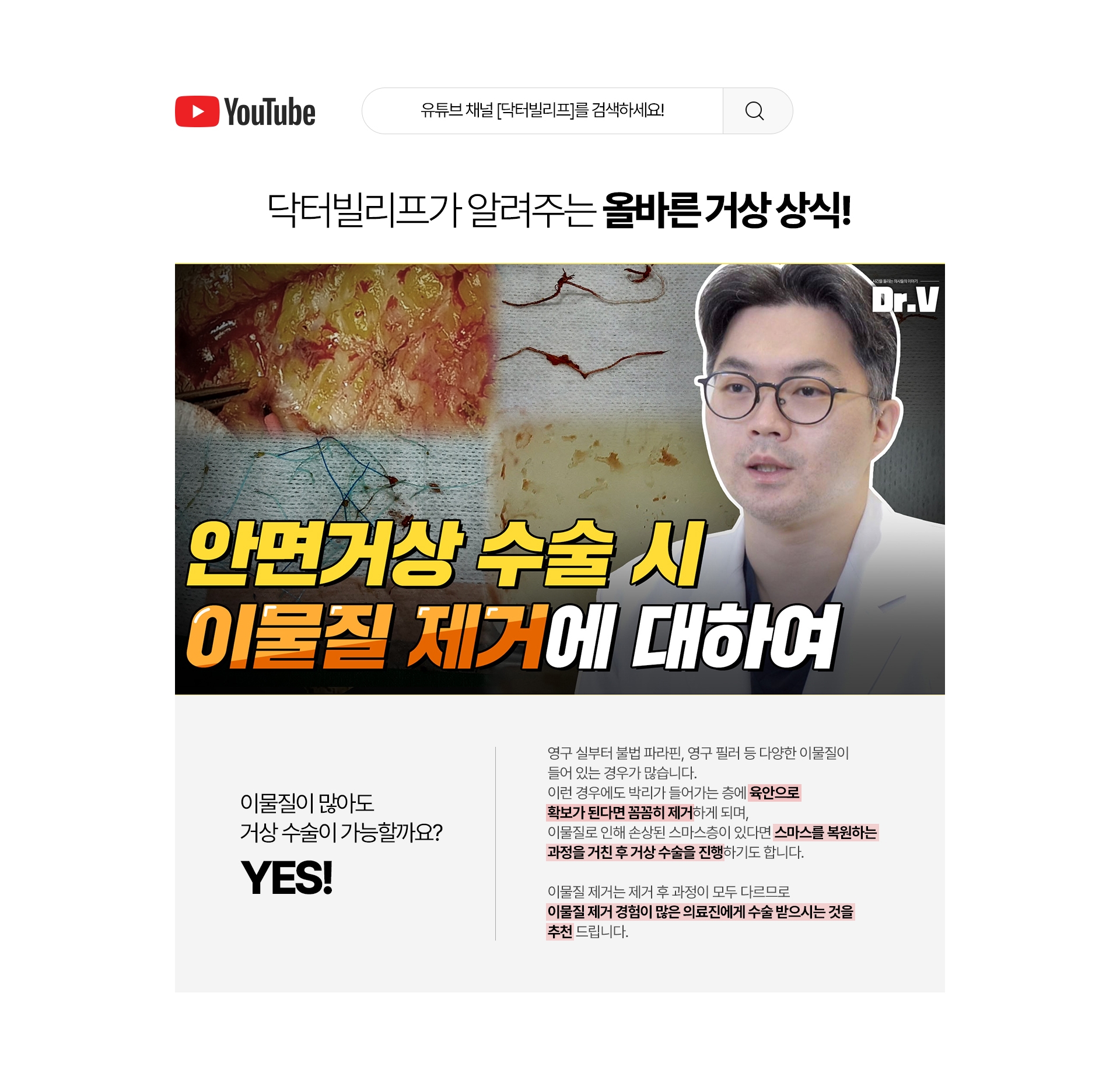 닥터빌리프가 알려주는 올바른 거상 상식! 이물질이 많아도 거상 수술이 가능할까요? Yes! 영구 실부터 불법 파라핀, 영구 필러 등 다양한 이물질이 들어 있는 경우도 많습니다. 이런 경우에도 박리가 들어가는 층에 육안으로 확보가 된다면 꼼꼼히 제거하게 되며, 이물질로 인해 손상된 스마스층이 있다면 스마스를 복원하는 과정을 거친 후 거상 수술을 진행하기도 합니다. 이물질 제거는 제거 후 과정이 모두 다르므로 이물질 제거 경험이 많은 의료진에게 수술 받으시는 것을 추천 드립니다.