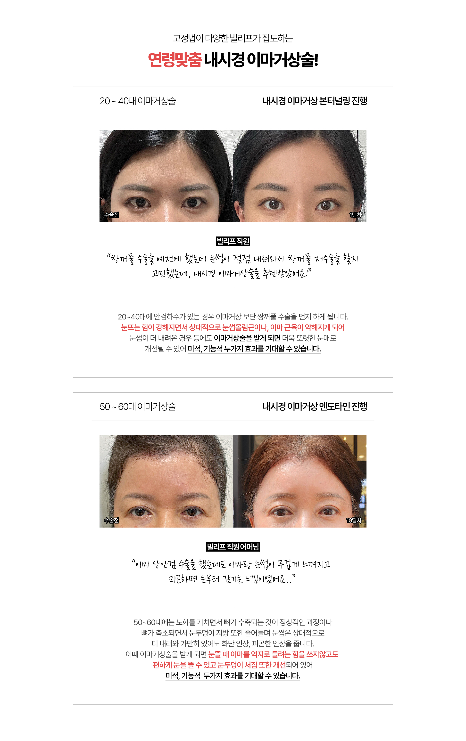 고정법이 다양한 빌리프가 집도하는 연령맞춤 내시경 이마거상술! 20~40 이마거상술 (내시경 이마거상 본터널링 진행 ) *빌리프 직원 쌍꺼풀 수술을 예전에 했는데 눈썹이 점점 내려와서 쌍꺼풀 재수술을 할지 고민했는데 내시경 이마거상술을 추천받았어요 20~40대에 안검하수가 있는 경우 이마거상 보단 쌍꺼풀 수술을 먼저 하게 됩니다. 눈뜨는 힘이 강해지면서 상대적으로 눈썹올림근이나, 이마 근육이 약해지게 되어 눈썹이 더 내려온 경우 등에도 이마거상술을 받게 되면 더욱 또렷한 눈매로 개선될 수 있어 미적, 기능적  두가지 효과를 기대할 수 있습니다. / 50~60 이마거상술 (내시경 이마거상 엔도타인 진행) *빌리프 직원 어머님 이미 상안검 수술을 했는데도 이마랑 눈썹이 무겁게 느껴지고 피곤하면 눈부터 감기는 느낌이였어요.. 50~60대에는 노화를 거치면서 뼈가 수축되는 것이 정상적인 과정이나 뼈가 축소되면서 눈두덩이 지방 또한 줄어들며 눈썹은 상대적으로 더 내려와 가만히 있어도 화난 인상, 피곤한 인상을 줍니다. 이때 이마거상술을 받게 되면  눈뜰 때 이마를 억지로 들려는 힘을 쓰지않고도 편하게 눈을 뜰 수 있고 눈두덩이 처짐 또한 개선되어 있어 미적, 기능적 두가지 효과를 기대할 수 있습니다. 