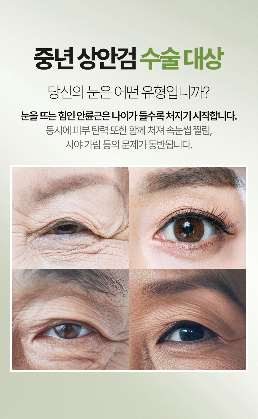 중년 상안검 수술 대상 당신의 눈은 어떤 유형입니까? 눈을 뜨는 힘인 안륜근은 나이가 들수록 처지기 시작합니다. 동시에 피부 탄력 또한 함께 처져 속눈썹 찔림, 시야 가림 등의 문제가 동반됩니다.