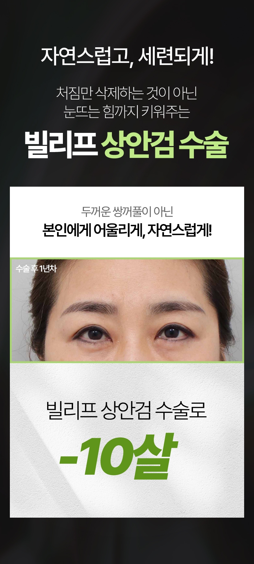 자연스럽고, 세련되게! 처짐만 삭제하는 것이 아닌 눈뜨는 힘까지 키워주는 빌리프 상안검 수술 두꺼운 쌍꺼풀이 아닌 본인에게 어울리게, 자연스럽게! 빌리프 상안검 수술로 -10살