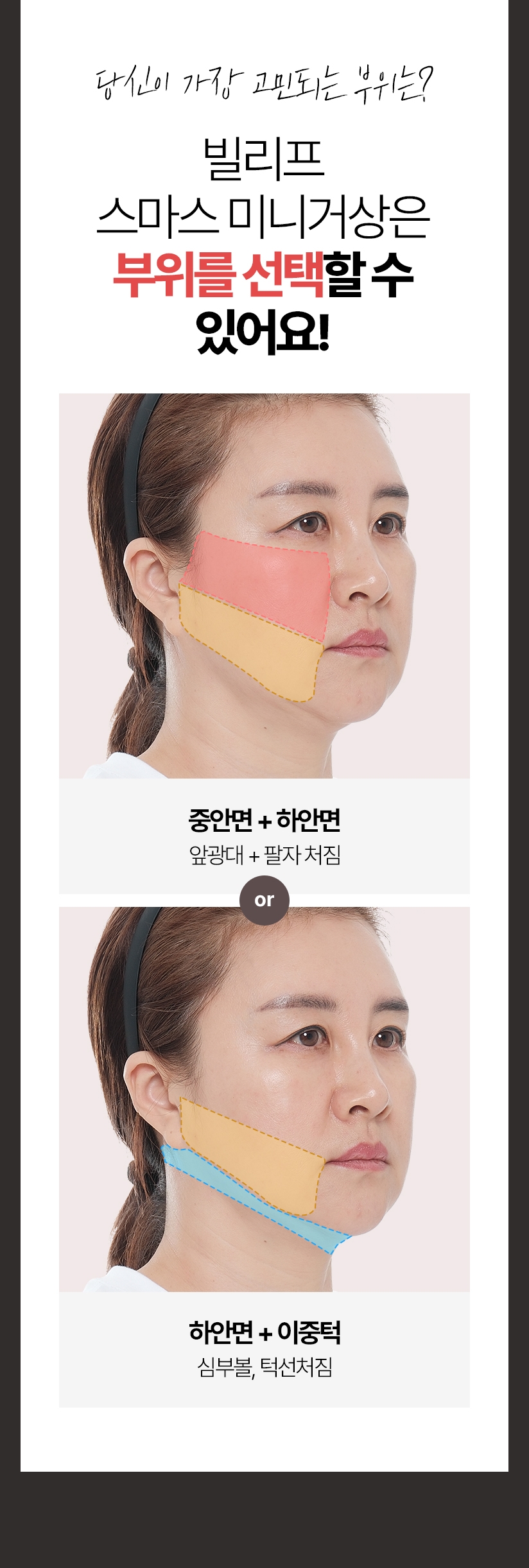 당신이 가장 고민되는 부위는? 빌리프 스마스 미니거상은 부위를 선택할 수 있어요! 이미지1 - 중안면+하안면, 앞광대+팔자 처짐 / 이미지2 하안면+이중턱, 심부볼, 턱선처짐