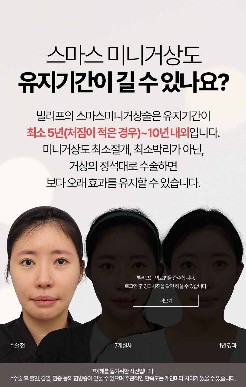 스마스 미니거상도   유지기간이 길 수 있나요? 빌리프의 스마스미니거상술은 유지기간이 최소 5년(처짐이 적은 경우)~10년 내외입니다 1년에서 1년6개월까지 흉살이 빠진 뒤부터는 만족스러운 결과가 오래 유지되는 것을 느끼실 수 있습니다.