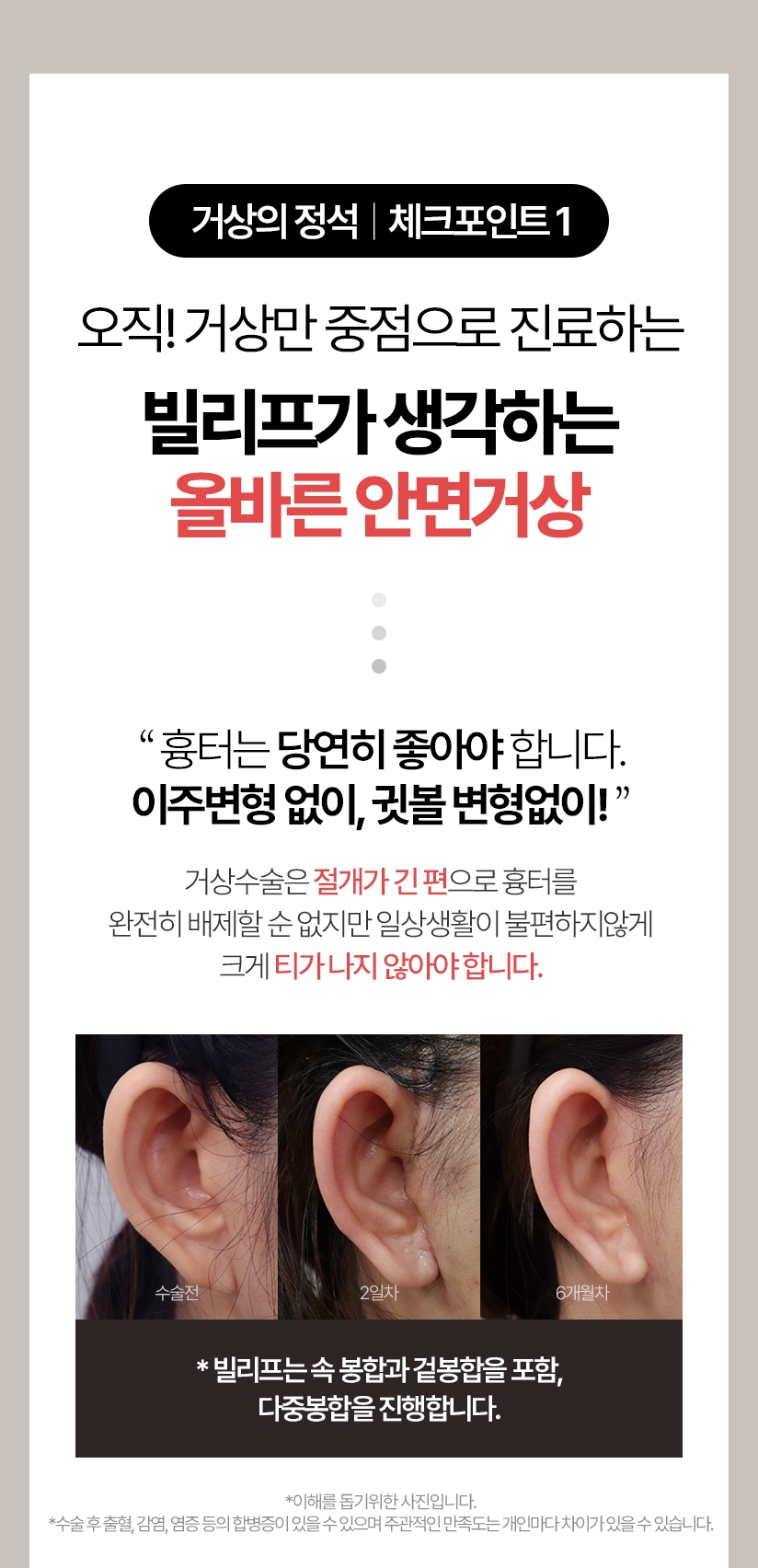 거상의 정석 체크포인트 1 - 오직! 거상만 중점으로 진료하는 빌리프가 생각하는 올바른 안면거상술 흉터는 당연히 좋아야 합니다. 거상수술은 절개가 긴 편으로 흉터를 완전히 배제할 순 없지만 일상생활이 불편하지않게 크게 티가 나지 않아야 합니다. *빌리프는 속 봉합과 겉봉합을 포함, 총 4중 봉합을 진행합니다.