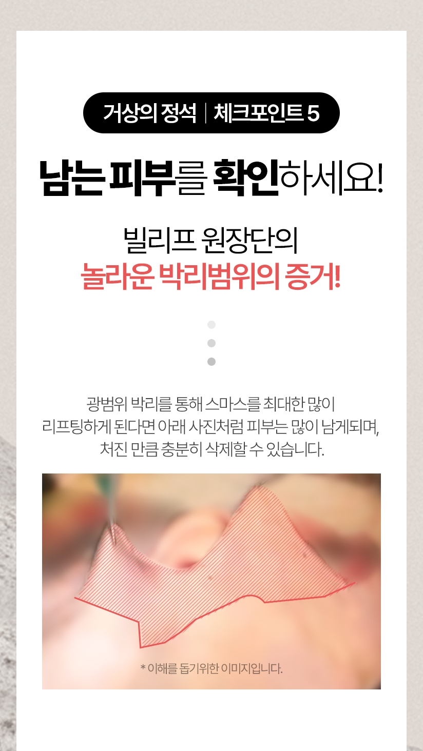 거상의 정석 체크포인트 5 - 남는 피부를 확인하세요! 빌리프 원장단의 놀라운 박리범위의 증거! 박리가 잘되면 처진피부는 충분히 삭제할 수 있습니다.