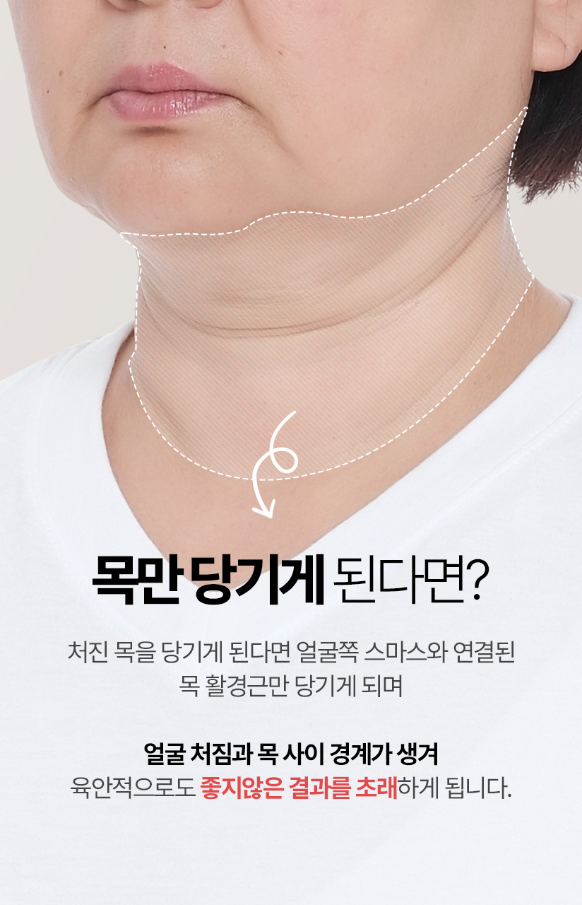 목만 당기게 된다면? 처진 목을 당기게 된다면 얼굴쪽 스마스와 연결된 목 활경근만 당기게되며 얼굴 처짐과 목 사이 경계가 생겨 육안적으로도 좋지않은 결과를 초래하게 됩니다.