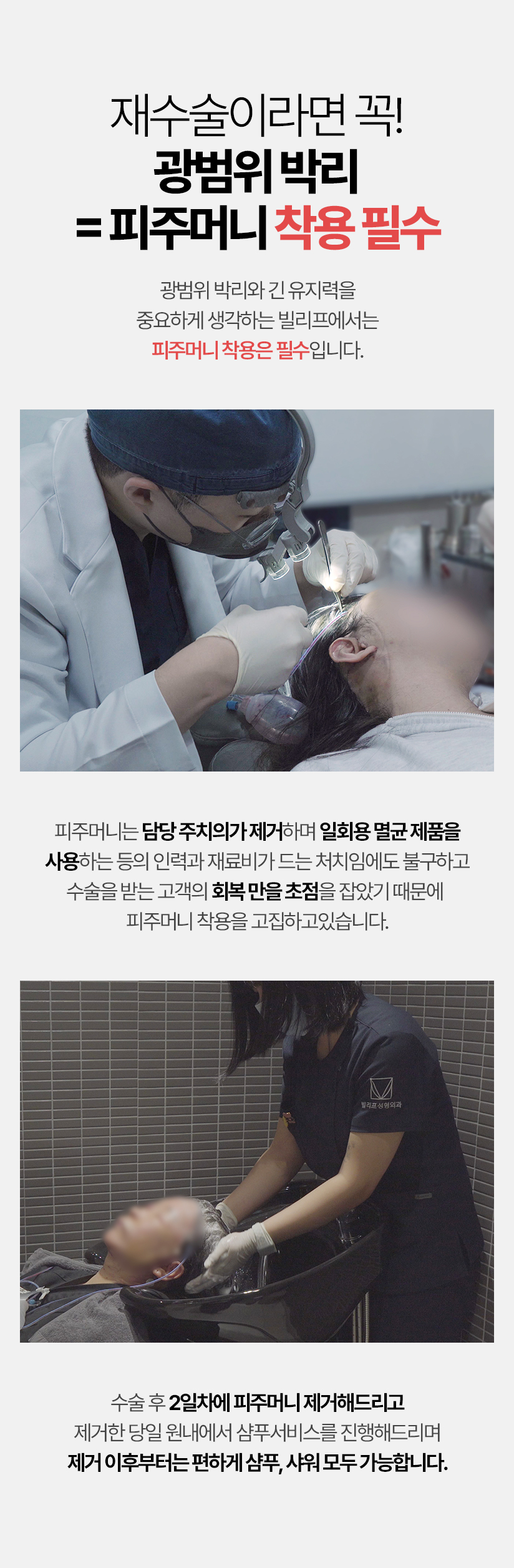 재수술이라면 꼭! 광범위 박리 = 피주머니 착용 필수 광범위 박리와 긴 유지력을 중요하게 생각하는 빌리프에서는 피주머니 착용은 필수 입니다. 피주머니는 담당 주치의가 제거하며 일회용 멸균 제품을 사용하는 등의 인력과 재료비가 드는 처치임에도 불구하고 수술을 받는 고객의 회복 만을 초점을 잡았기 떄문에 피주머니 착용을 고집하고 있습니다. 수술 후 2일차네 피주머니 제거해드리고 제거한 당일 원내에서 샴푸서비스를 진행해드리며 제거 이후부터는 편하게 샴푸, 샤워 모두 가능합니다.