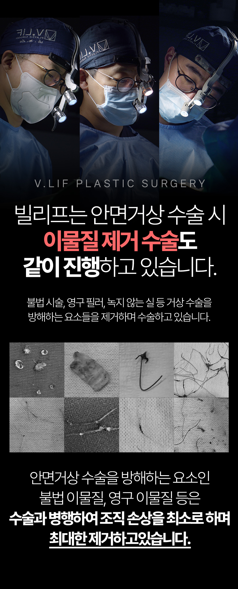 빌리프는 안면거상 수술 시 이물질 제거 수술도 같이 진행하고 있습니다.불법 시술, 영구 필러, 녹지 않는 실 등 거상 수술을 방해하는 요소들을 제거하며 수술하고 있습니다. 여러개중에 자극적인것만 골라서 하면될것같습니다 전체적으로 하나로 뭉친 뒤 컬러만 흑백처리 부탁드립니다! 안면거상 수술을 방해하는 요소인 불법 이물질, 영구 이물질 등은 수술과 병행하여 최대한으로 제거를 진행하고 있습니다.