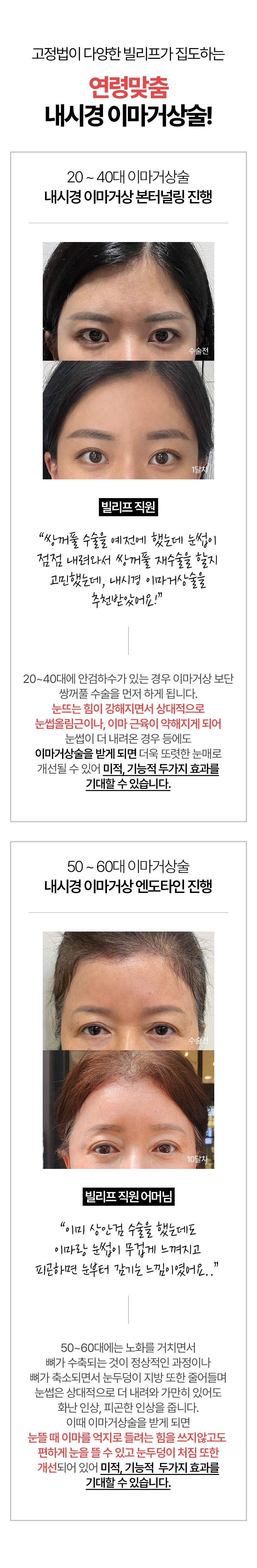 고정법이 다양한 빌리프가 집도하는 연령맞춤 내시경 이마거상술! 20~40 이마거상술 (내시경 이마거상 본터널링 진행 ) *빌리프 직원 쌍꺼풀 수술을 예전에 했는데 눈썹이 점점 내려와서 쌍꺼풀 재수술을 할지 고민했는데 내시경 이마거상술을 추천받았어요 20~40대에 안검하수가 있는 경우 이마거상 보단 쌍꺼풀 수술을 먼저 하게 됩니다. 눈뜨는 힘이 강해지면서 상대적으로 눈썹올림근이나, 이마 근육이 약해지게 되어 눈썹이 더 내려온 경우 등에도 이마거상술을 받게 되면 더욱 또렷한 눈매로 개선될 수 있어 미적, 기능적  두가지 효과를 기대할 수 있습니다. / 50~60 이마거상술 (내시경 이마거상 엔도타인 진행) *빌리프 직원 어머님 이미 상안검 수술을 했는데도 이마랑 눈썹이 무겁게 느껴지고 피곤하면 눈부터 감기는 느낌이였어요.. 50~60대에는 노화를 거치면서 뼈가 수축되는 것이 정상적인 과정이나 뼈가 축소되면서 눈두덩이 지방 또한 줄어들며 눈썹은 상대적으로 더 내려와 가만히 있어도 화난 인상, 피곤한 인상을 줍니다. 이때 이마거상술을 받게 되면  눈뜰 때 이마를 억지로 들려는 힘을 쓰지않고도 편하게 눈을 뜰 수 있고 눈두덩이 처짐 또한 개선되어 있어 미적, 기능적 두가지 효과를 기대할 수 있습니다. 