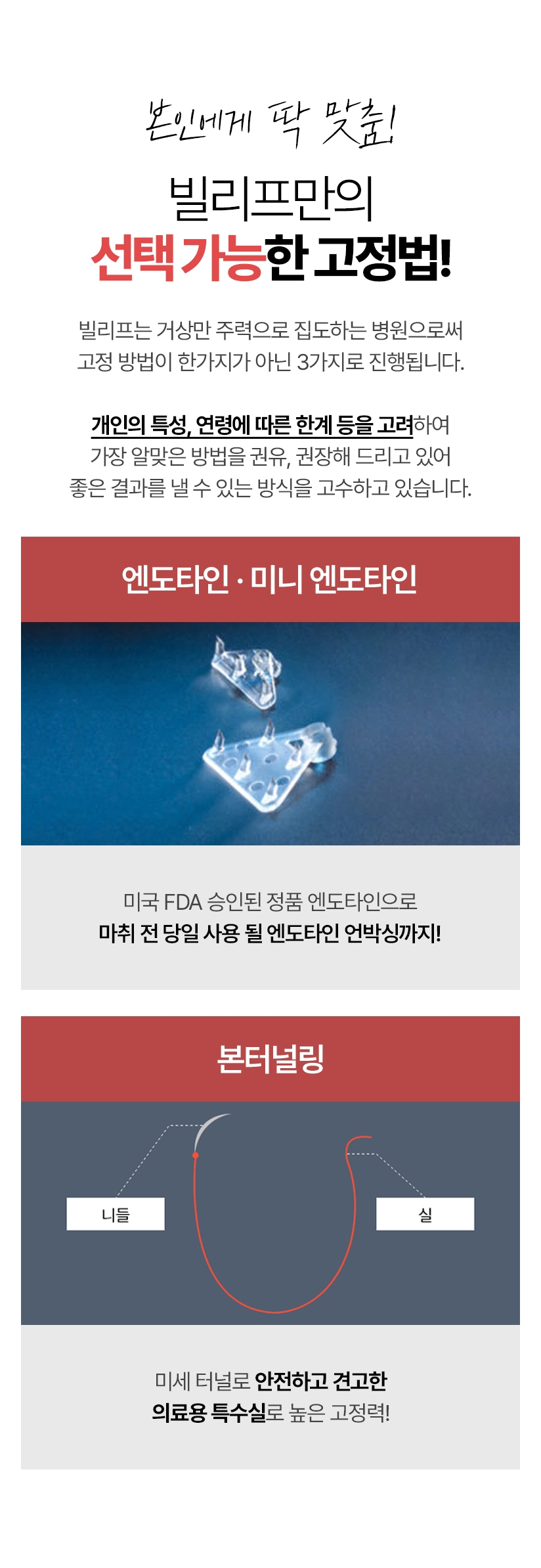 본인에게 딱 맞춤! 빌리프만의 선택 가능한 고정법! 빌리프는 거상만 주력으로 집도하는 병원으로써 고정 방법이 한가지가 아닌 3가지로 진행됩니다. 개인의 특성, 연령에 따른 한계 등을 고려하여 가장 알맞은 방법을 권유, 권장해 드리고 있어 좋은 결과를 낼 수 있는 방식을 고수하고 있습니다. 엔도타인.미니엔도타인 - 미국 FDA 승인된 정품 엔도타인으로 마취 전 당일 사용 될 엔도타인 언박싱까지! / 본터널링 - 미세 터널로 안전하고 견고한 의료용 특수실로 높은 고정력!