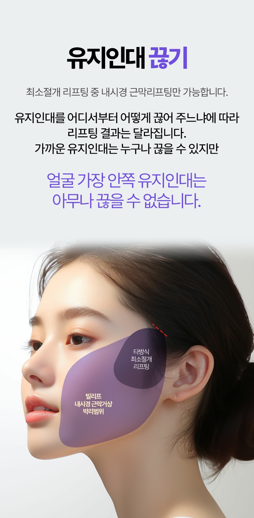 유지인대 끊기 최소절개 리프팅 중 내시경 근막리프팅만 가능합니다. 타방식최소절개 리프팅 - 빌리프내시경 근막거상 박리범위 유지인대를 어디서부터 어떻게 끊어 주느냐에 따라 리프팅 결과는 달라집니다. 가까운 유지인대는 누구나 끊을 수 있지만 얼굴 가장 안쪽 유지인대는 아무나 끊을 수 없습니다.