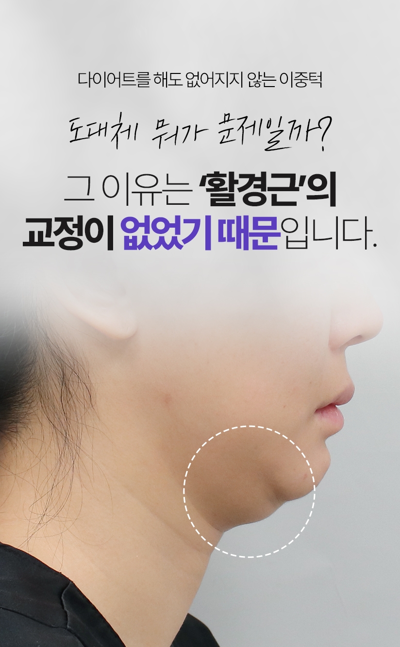 다이어트를 해도 없어지지 않는 이중턱 도대체 뭐가 문제일까? 그 이유는 ‘활경근’의 교정이 없었기 때문입니다.