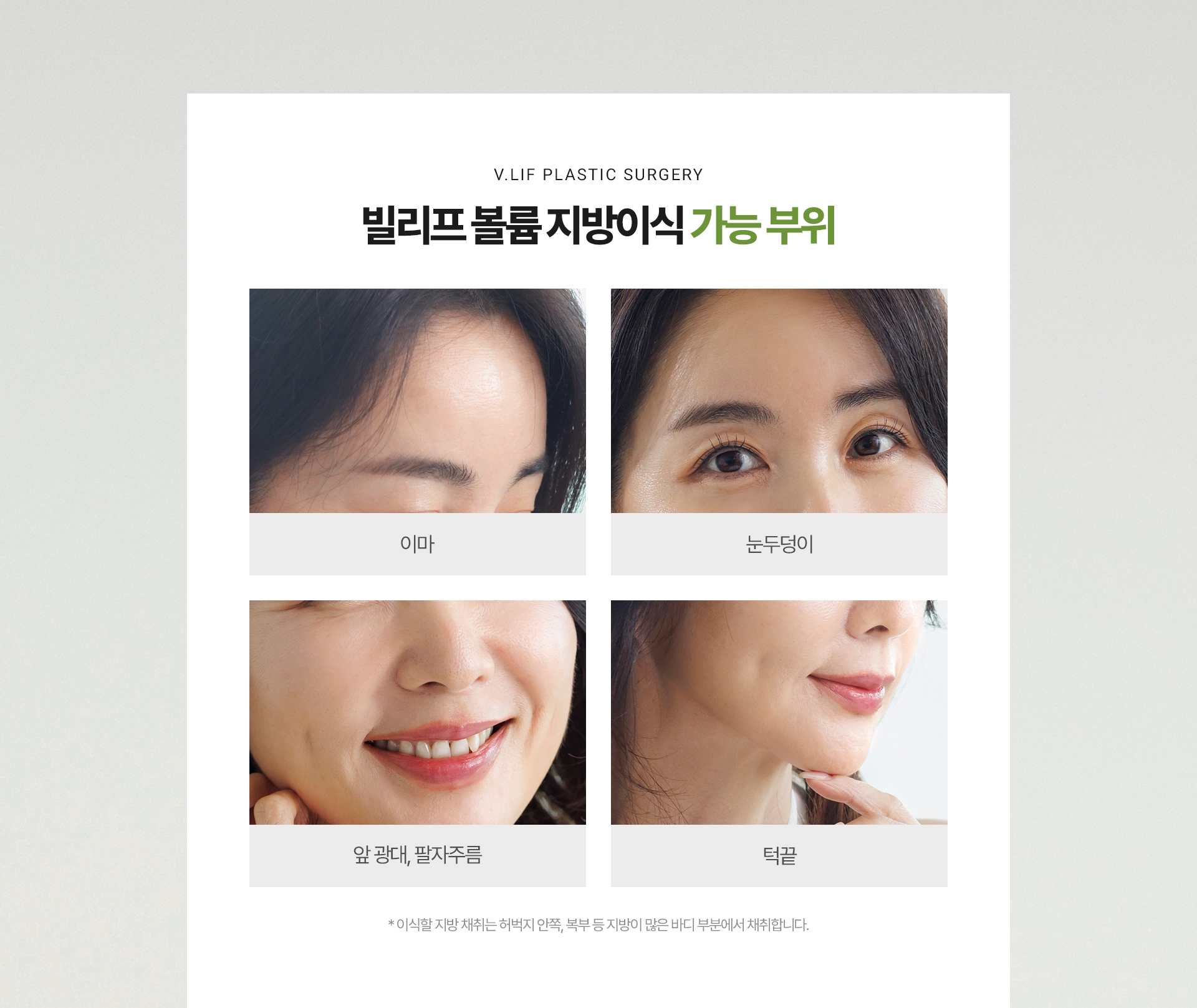 빌리프 볼륨 지방이식 가능 부위 이마 눈두덩이 앞 광대, 팔자주름 턱끝 *이식할 지방 채취는 허벅지 안쪽, 복부 등 지방이 많은 바디 부분에서 채취합니다.